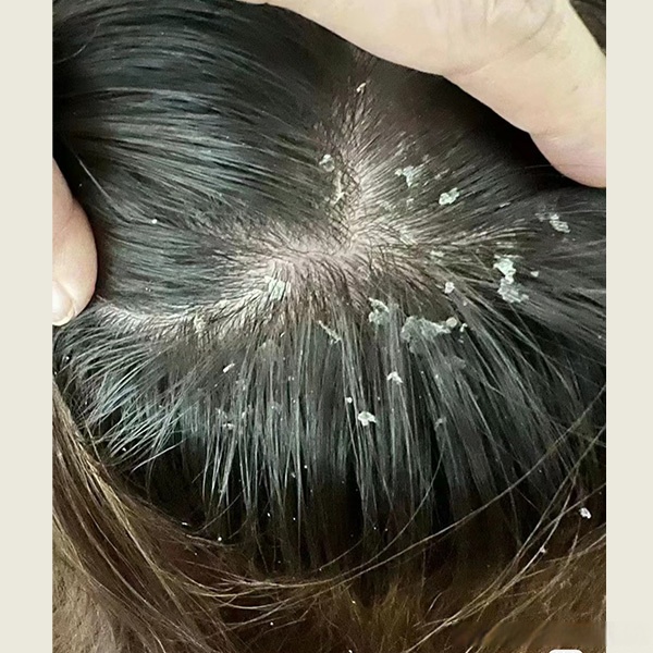 陈健云医生-陈健云医生详细介绍-康复科专家擅长疾病-复禾健康(图1)