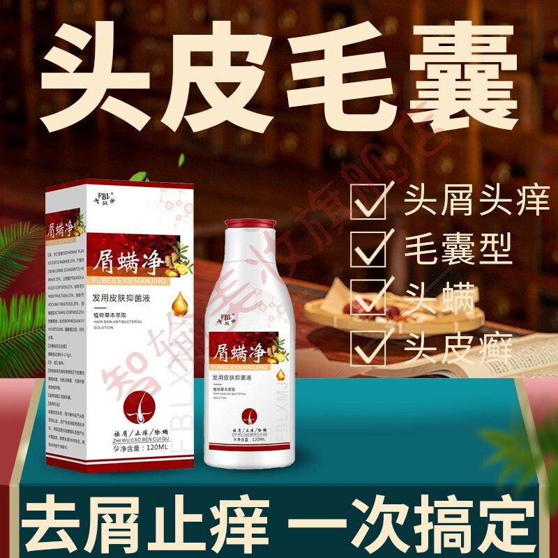 哪种洗发水去屑好(图1)